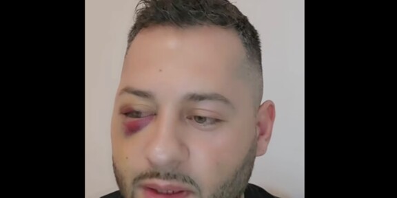 CONSTANŢA. Poliţiştii l-au identificat pe bărbatul care l-a bătut pe fostul preot Daniel Balaș. „Am 3 fracturi grave! Oare trăim în junglă?”